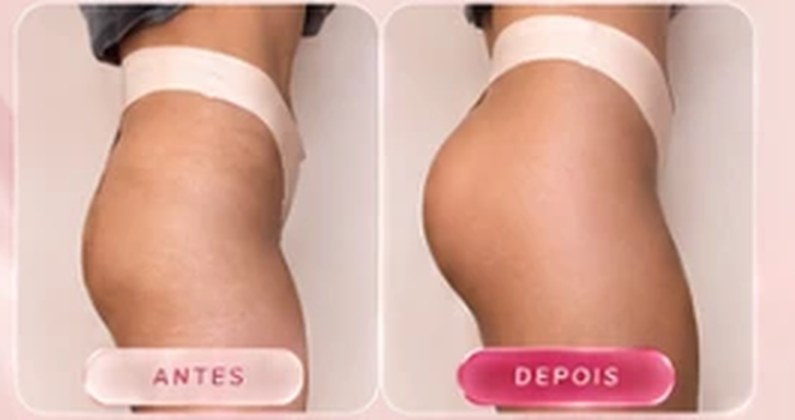 Imagem ilustrativa de antes e depois da região dos glúteos, da arte oficial da campanha